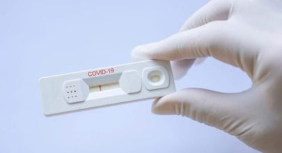 Ministry will launch a new COVID rapid test kit for only 2 next week